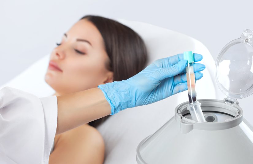 Woman is ready to get her PRP Facial Rejuvenation